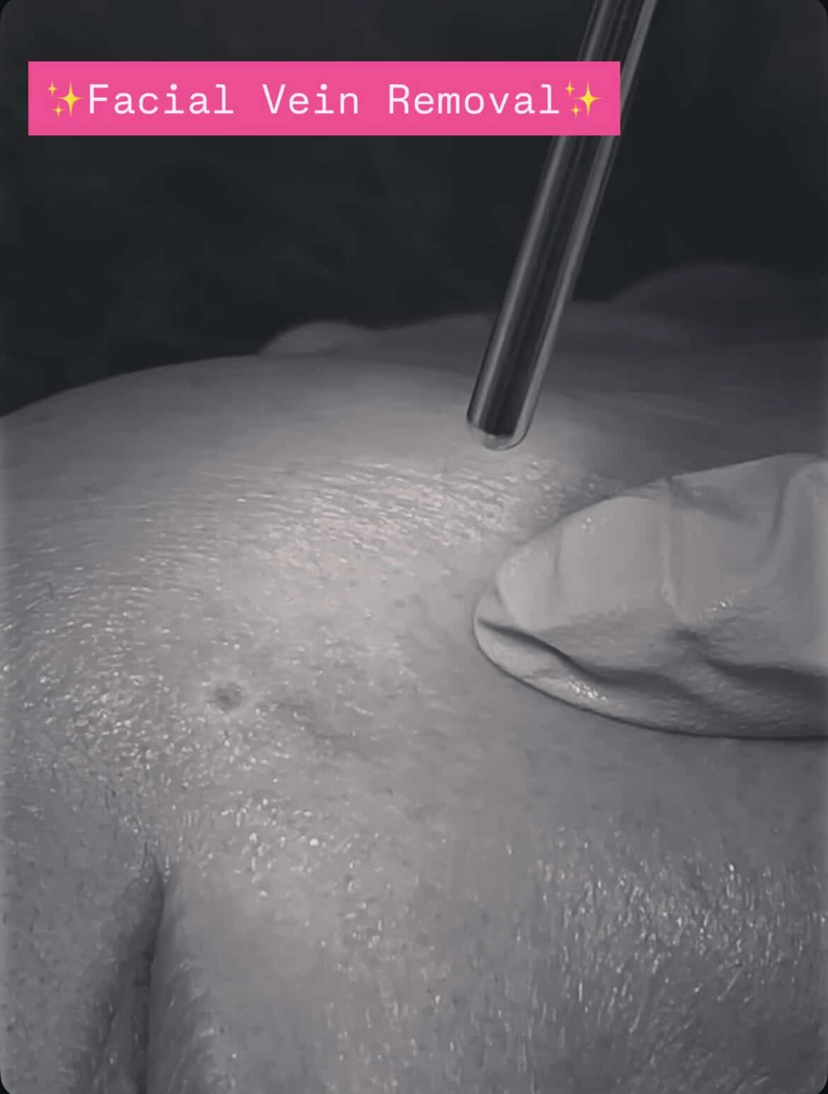 Body Contouring Patient 2